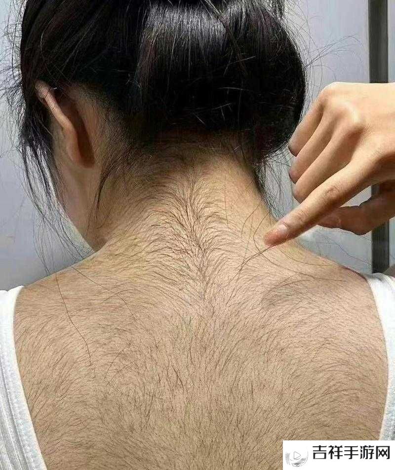 18-20 岁女生长出一片毛,这正常吗?